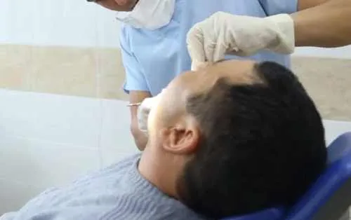 34813 sensitive teeth whitening causes